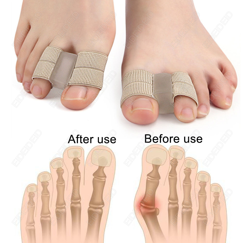 Bunion toe Corrector Orthotics - Women'S Shoes For Bunions review and price